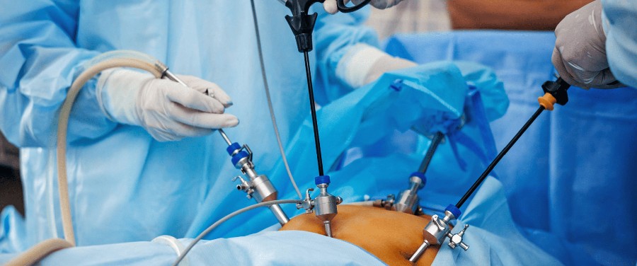 बिहार के मरीज को मिली नई जिंदगी,  सफल लेप्रोस्कोपी से बची किडनी