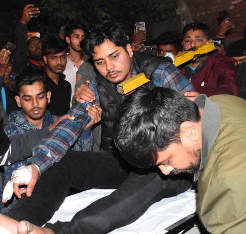 तेज रफ्तार गाड़ी साइकिल सवार को रौंद रेलिंग से टकराई, सीने के आर पार हुआ रॉड